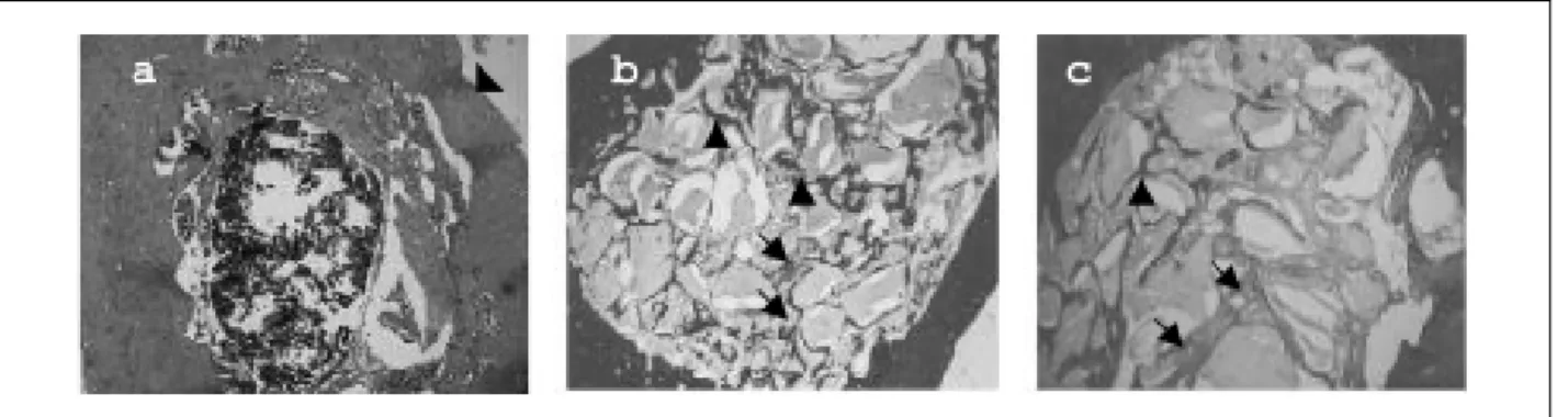 Figure 3. Photomicrography of group III. Left: At day 15, complete cortical repair was observed (arrowhead)