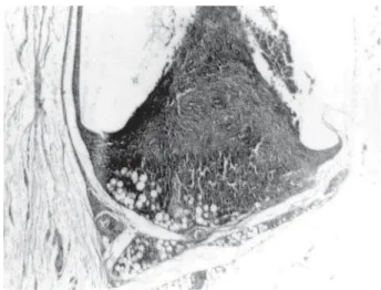 Figure 2. Experimental group - 14 days. The inflammatory reaction around the ends of the tubes was extensive, showing mononuclear cells and bleeding points
