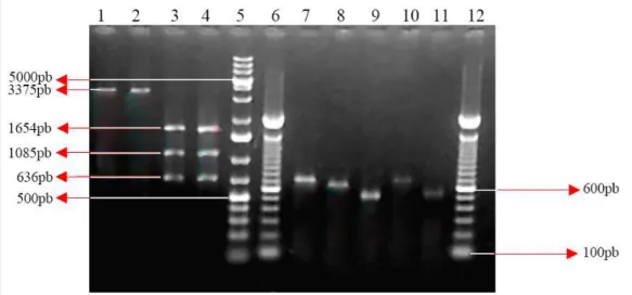 Figura 1 - Caracterização de genes do cluster egc em S. aureus padrão e em isolados em alimentos de origem animal na cidade de Pelotas, RS: eletroforese em gel de agarose 1% – Coluna 1: fragmento do cluster