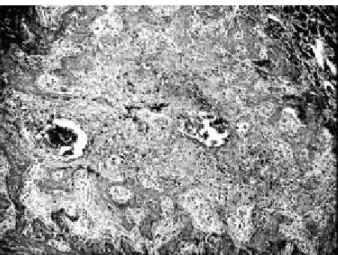 Figure 2. Control Group. 21 days postoperative. Presence of thick osseous trabeculae and some areas of mature connective tissue