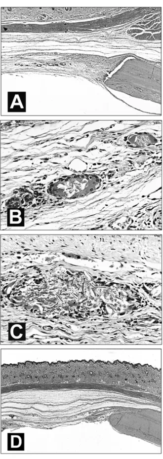 Figure 2. Experimental group. A-C: 1 month after surgery: A) defect filled with fibrous connective tissue and foci of a foreign body-type granuloma; B) detail of foreign body-type granuloma, and C) agglomerates of needle-shaped hydroxyapatite particles.