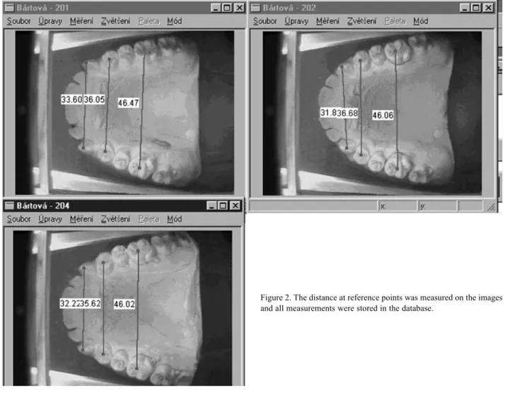 Figure 2. The distance at reference points was measured on the images and all measurements were stored in the database.