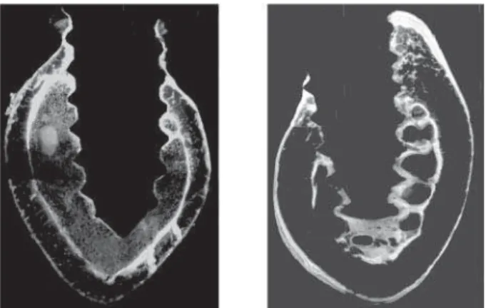 Figure 2. Bone bridges linking the endosteum to the surface of the implant.