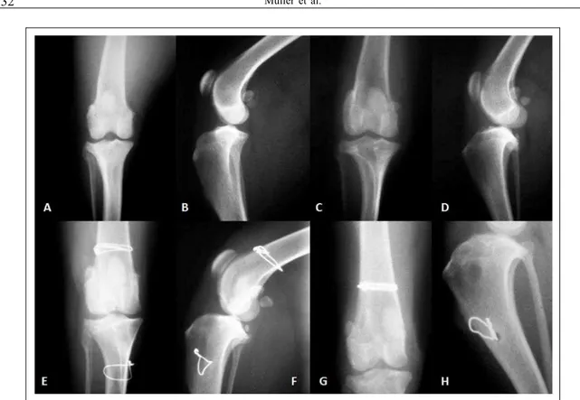 Figura 4 - Imagem antero-posterior (A) e latero-lateral (B) da articulação saudável. Imagem antero-posterior (C) e latero-lateral (D) da articulação 21 dias após a desmotomia dos LCC e LCA