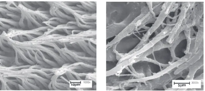 Figure 2. Group 2. Left: Resin replica of the dentin where a regular tag distribution can be observed, with deep penetration (1000X)