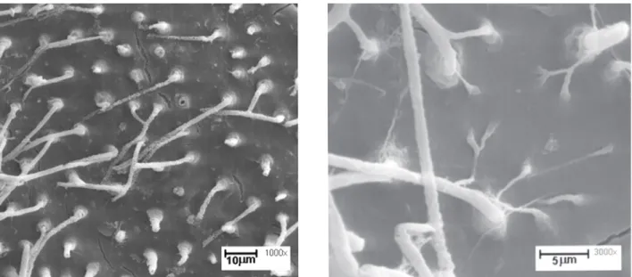 Figure 4. Group 4. Left: An irregular etch pattern was observed in the dentin, with small island formation with good penetration (1000X)