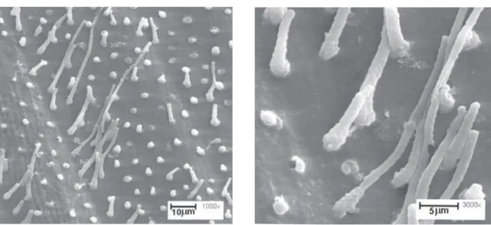 Figure 6. Group 6. Left: Resin sample of the dentinal surface. A poor and irregular etch pattern was observed (1000X)
