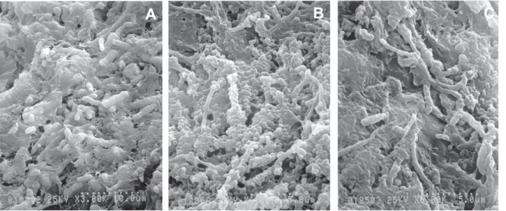 Figure 2. SEM micrographs of non-irradiated areas of the apical root third. A: Presence of microbiological apical biofilm (3000X); B: