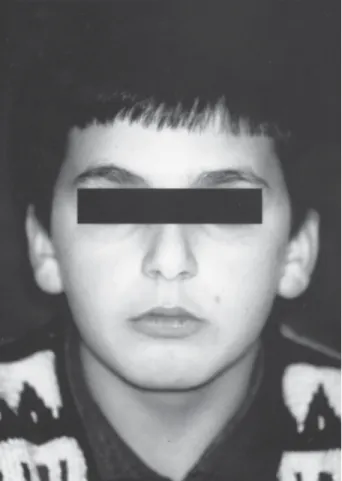 Figure 2. Buccal appearance of the maxillary permanent incisors.