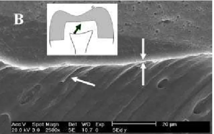 Figure 2a. Resin/dentin interface at the pulpal wall.  Single Bond (2500X); Opposing arrows delimitate the hybrid layer; the other arrow indicate resin tags.