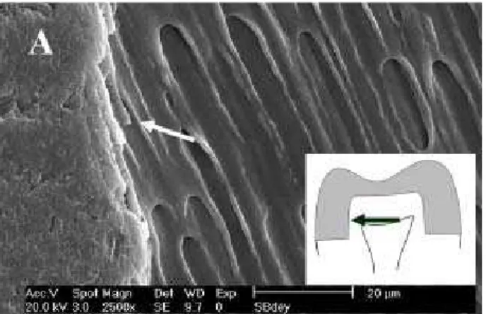 Figure 3a. Resin/dentin interface at the axial wall. Single Bond (2500X). The arrow indicates the formation of resin tags.