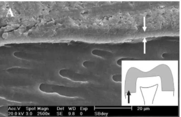 Figure 4c. Resin/dentin interface at the axial-gingival line angle.