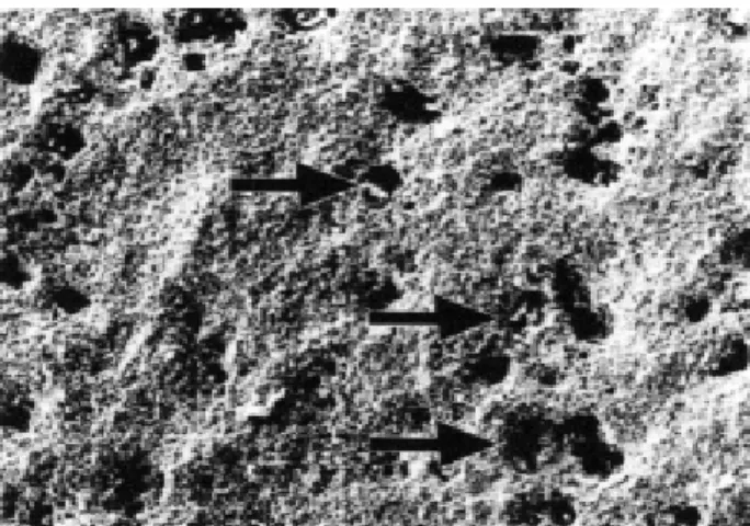 Figure 4. Thompson stone surface was irregular with few gaps between the particles (SEM: 500X).
