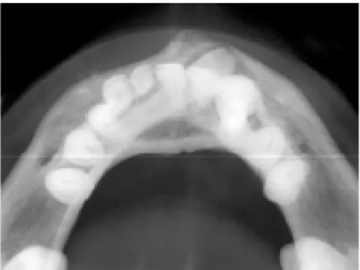 Figure 5. Panoramic radiograph showing normal bone tissue and