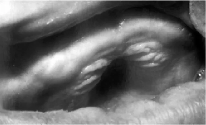 Figure 4. Panoramic radiograph revealing the presence of several impacted primary and permanent teeth.