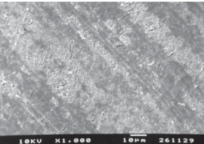 Figure 1. Group 1. SEM micrograph of diseased root surface after scaling and root planing