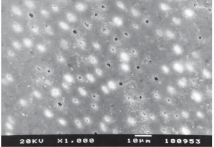 Figure 7. Group 4. SEM micrograph of diseased root surface after multiple applications of Carisolv TM   plus scaling and root planing, showing an amorphous appearance with small circular mounds, resembling healthy cementum.