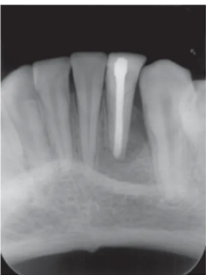 Figure 5. 24-month follow-up radiograph.