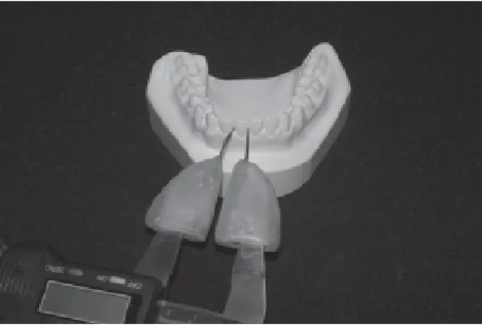 Figure 1. Digital pachymeter with an acrylic pointer inlaid with a wire to measure mesiodistal dental diameter.