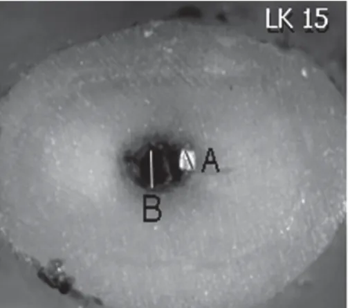 Figure 3. Group 3 (cervical and middle preflaring with Gates- Gates-Glidden drills). Transverse section at WL