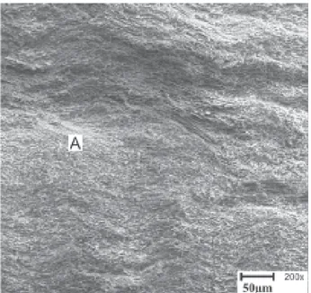 Figure 1. Photomicrograph of a debonded resin surface (Group 1). Mixed failure. A: cohesive failure in enamel; B: adhesive failure.