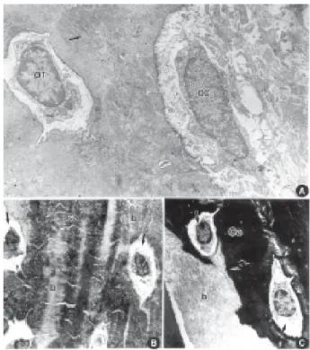 Figure 2. A= Bone matrix decalcified by immersion: collagen fibers (arrow); osteocyte inside the lacunae (OT);  osteoclasts (OC) (X10.000)