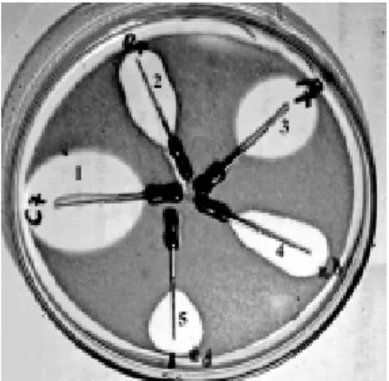 Figure 1. Residual antibacterial activity against Micrococcus luteus ATCC 9341. Starting in C4, in a clockwise direction, the inhibition halos correspond to: 1 - Ca(OH) 2 /2% chlorhexidine (control sample); 2 - Calen ® /CMCP; 3 - Calen ® ; 4 - Ca(OH) 2 / a