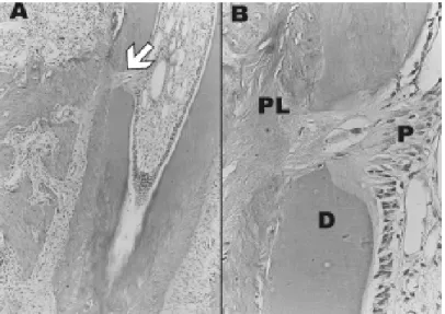 Figure 7. Photomicrograph of histological sections of accessory root canal of molars for the 72-h group