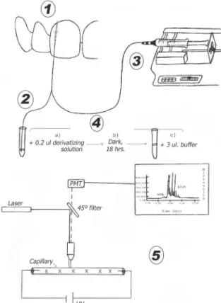 Figure 1. Schematic presentation of GCF sample collection and analysis. 1= Straight probe introduced in the gingival sulcus in the distobuccal region of a maxillary central incisor; 2= GCF collected in a microhematocrit tube; 3= Other side of the probe con