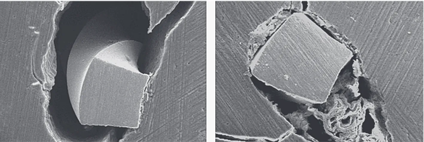 Figure 2. SEM micrograph of Group 2 (preflaring with Gates Glidden drills). Cross-section at the working length (original magnification