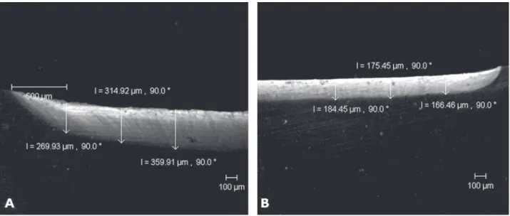 Figure 1. Analysis of artificial caries depth in permanent teeth produced by biological (A) and chemical (B) models by CLSM (4x/