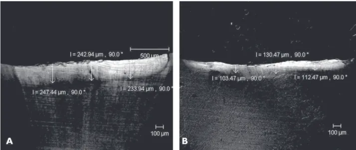 Figure 3. Analysis of artificial caries depth in primary teeth produced by biological (A) and chemical (B) models by CLSM (4x/0.13 corr).