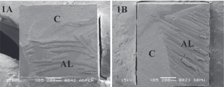 Table 2. µTBS means (±SD) in MPa for the experimental groups.