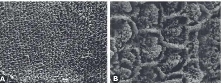 Figure 3. Enamel surface etched with Er:YAG laser. Irregular areas on the surface due to tissue removal and intact area can be observed.