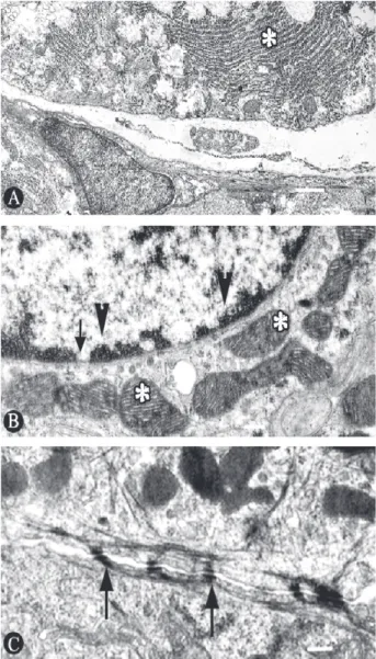 Figure 1. TEM micrographs of GI animals. A: Granular endoplasmic reticulum with an irregular, condensed aspect (*) (×12,000); B: Condensed chromatin (arrow) in the periphery of the nucleus of the cells (arrowheads) and mitochondria presenting parallelism o