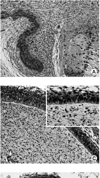 Figure  1.  Immunolocalization  of  DMP1  in  tooth  germs  (A-E)  and  erupted  teeth  (F)