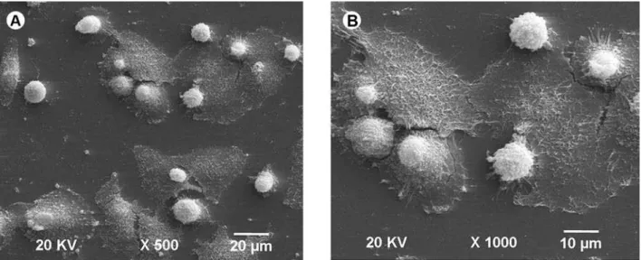 Figure 2. SEM micrographs of G1 (bleaching gel): A = Few MDPC-23 cells remained adhered to the glass substrate (×500 original  magnification);  B = Greater magnification of “A” showing that cytoskeletal shrinkage reduced significantly the cell size, leavin