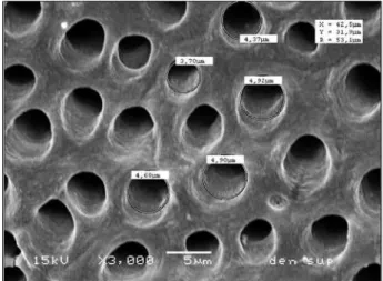 Table  1  shows  the  dentin  tubule  diameters  for 