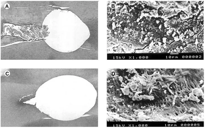 Figure 1. A = Photomicrograph (×40) of the apical region irrigated with distilled and deionized water showing root canal areas not  touched by the instrument and presence of debris; B = SEM micrograph (×1000) showing dentin surface totally covered by smear