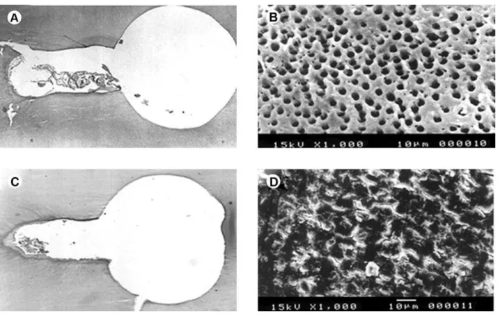 table 1. Mean percentage of debris ( Sd)  in flattened root canals  for each group tested