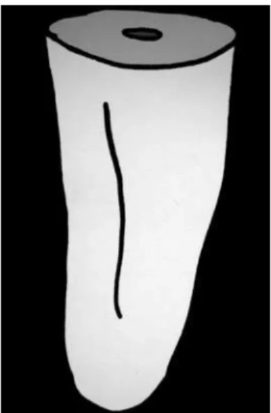 Figure 2. Coronal tooth structure reduced to a flat plane at height  of 3.0 mm.