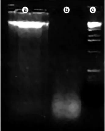 Figure  4.  Agarose  gel  electrophoresis  of  the  genomic  DNA.  First  lane  (A):  Permanent  teeth  showing  a  more  intense  smear  near  the  origin  of  migration