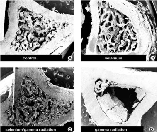 Figure 1. Panel of SEM micrograph on the 45th day of bone repair. Note the presence of thick cortical bone plates with spongious  bone between them in the control (A), selenium (B) and selenium/gamma radiation (C) groups
