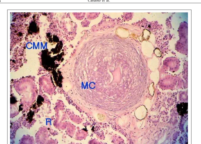 Figura 1 - Peixe-espada (Trichiurus lepturus) – Rim. Fragmento mostrando nódulo cartilaginoso (Metaplasia Cartilaginosa – MC) envolto em fina camada de tecido conjuntivo cercado por parênquima renal (R) e ninhos de corpos melanomacrofágicos (CMM) de colora