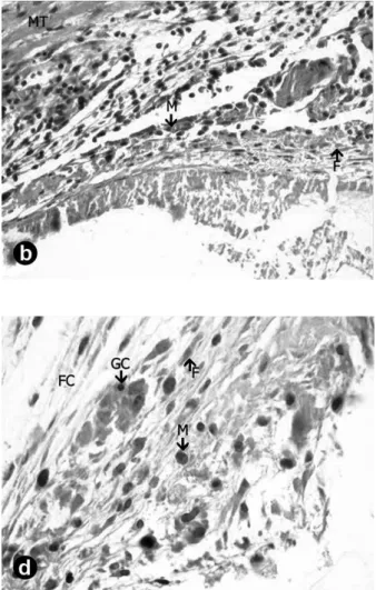 Figure 1. Calen paste plus 0.4 CHX: A and B - On day 7, reactionary tissue was thin with mild exudate, being also rich in macrophages  (M) and young fibroblast (F) presenting discrete fibrosing activity (HE; A = ×4 and B = ×40)