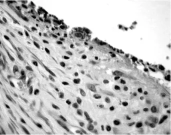 Figure 2. Tissue response to MTA. A (7 days):  A foreign-body giant cell can be seen engulfing particles of MTA (arrow) at tissue-material  interface (arrowhead)