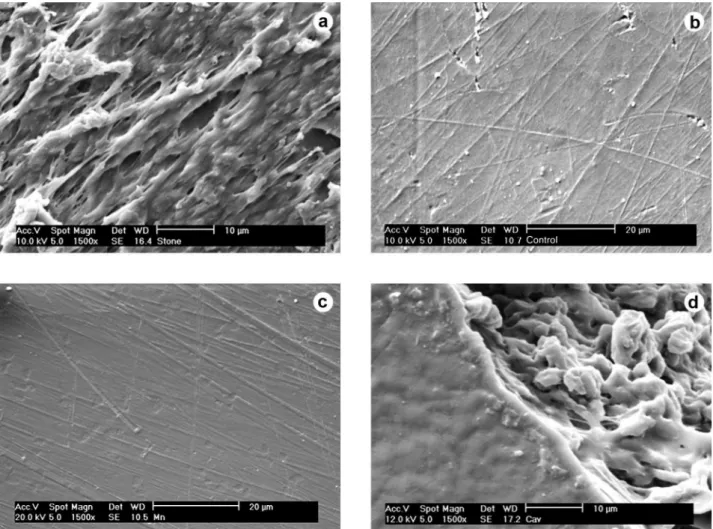 Figure 4. Images obtained in the SEM analysis after surface treatment. A) SEM micrograph of tooth surface after glaze removal with aluminum  oxide abrasive stone; B) SEM micrograph of original (non-treated) tooth surface; C) SEM micrograph of monomer treat