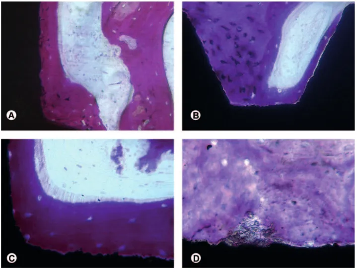 Figure 2. Histologic images evidencing a high level of bone-implant contact achieved with different improvements on implant surfaces