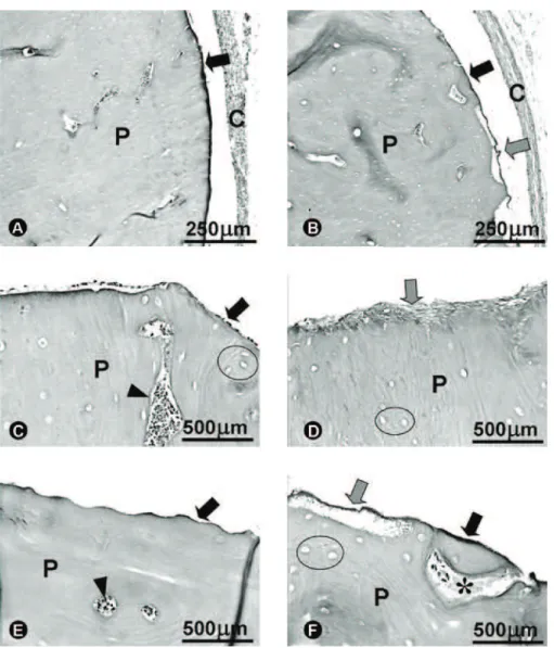 Figure 5. Photomicrograph of DCBB-pin surface: A= at 7 days, panoramic aspect of pin (P) showing non-resorbed surface (black  arrow) and fibrous capsule (C); B= pin head (P) exhibiting non-resorbed surface, large pores (arrowhead) filled by blood clot and 