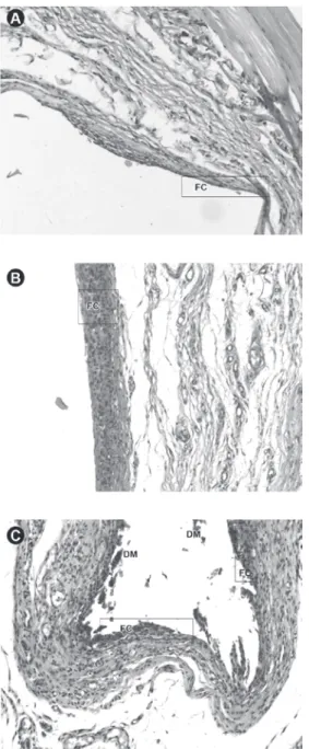 Figure 6. Mean thickness (μm) of fibrous capsule at the interface  with the tested cements (Groups I and II) and Control Group after  periods of 21 and 42 days